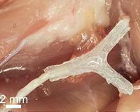 Toward dissolvable electronics for implants and sensors