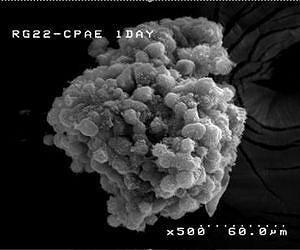Tiny tools hit brain tumors with big radiation