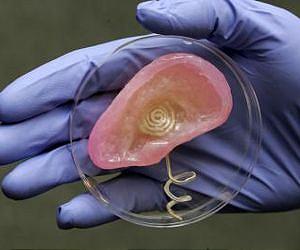 Printable 'bionic' ear melds electronics and biology