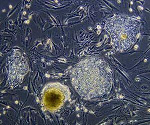 Erasing the signs of aging in cells is now a reality