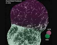 Human forebrain circuits under construction - in a dish