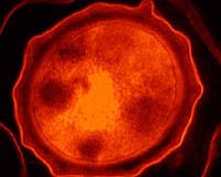 Taming The Anthrax Threat