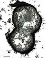 Life's Origins Were Easier Than Was Thought