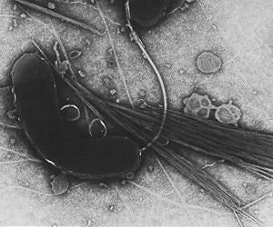 Burundi's longest cholera epidemic kills at least 17