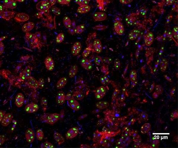 Study first to tally biomass from oceanic plastic debris using visualization method