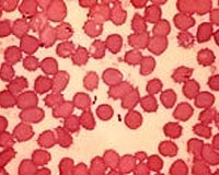 Pneumonic plague kills eight in Madagascar