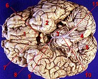 Microscopic Brain Imaging In The Palm Of Your Hand