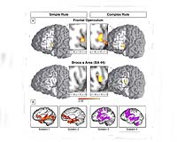 Brain Researchers Discover The Evolutionary Traces Of Grammar