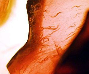 Tiny amounts of alcohol dramatically extend lifespan of a worm