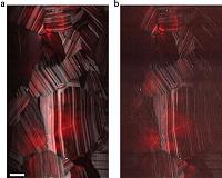 Beating the limits of the light microscope, one photon at a time