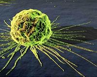 Speeding up cancer screening