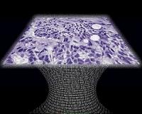Lens-free microscope can detect cancer at the cellular level