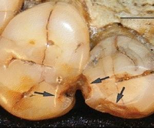 A Chip Off the Early Hominin Tooth