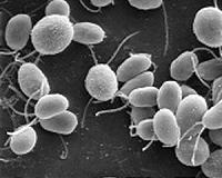 Tiny plant shows us how living things cope with big changes