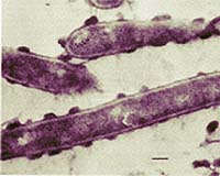 Genome Sequencing Reveals A Key To Viable Ethanol Production