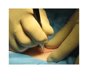 More Than 2 Billion People Worldwide Lack Access To Surgical Services