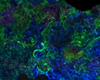 Engineers Create Bone That Blends Into Tendons