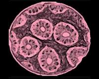 Synthetic molecule makes cancer self-destruct