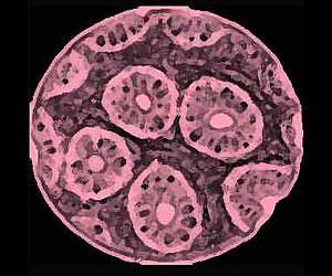 Chemists modify sea bacteria byproduct for use as potential cancer drug