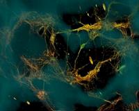 Bioengineers create functional 3-D brain-like tissue