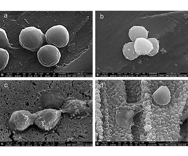 New copper surface eliminates bacteria in just two minutes