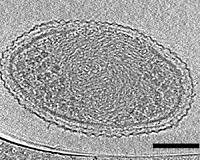 First Detailed Microscopy Evidence of Bacteria at the Lower Size Limit of Life