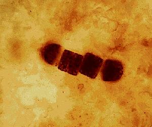 Amoeba may offer key clue to photosynthetic evolution
