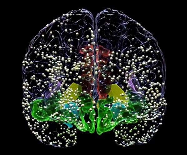 The race to link our brains to computers is hotting up