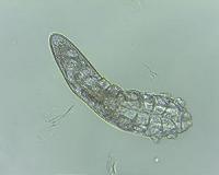 Scientists say face mites evolved alongside humans