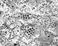 Dengue's spread flies under the radar amid Ebola scare
