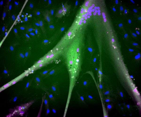 Another step away from the farm: meat grown from immortal stem cells