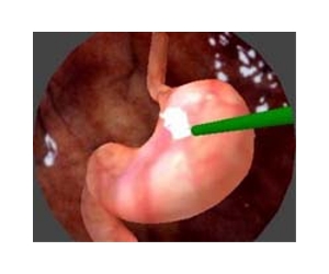 Will bubble-powered microrockets zoom through the human stomach?