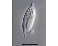 Researchers capture first glimpse of important, abundant ocean microbe