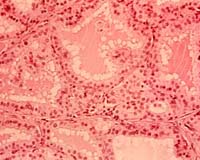 Incentive Plan Targets Neglected Diseases