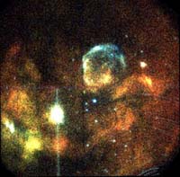 Columbia Gets X-ray Vision