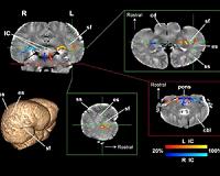 First images of dolphin brain circuitry hint at how they sense sound