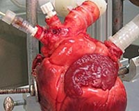 Beating Heart Machine Expedites Research And Development