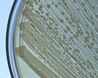 In the lab, scientists coax E. coli to resist radiation damage
