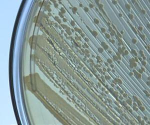 High-octane bacteria could ease pain at the pump