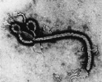 Ebola Test Urgent Amid Globalism