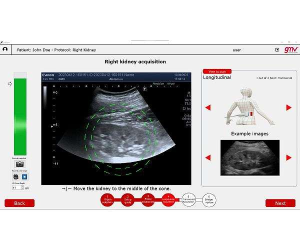 Just add AI for expert astronaut ultrasound