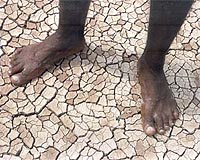 7.5 million going hungry as Ethiopia crisis worsens
