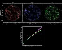Centenary of cosmological constant lambda