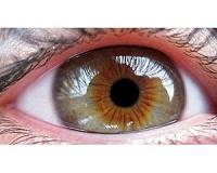 Eyes came before limbs in the transition to land