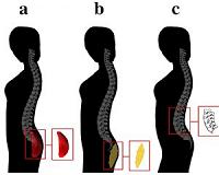 Men's preference for certain body types has evolutionary roots