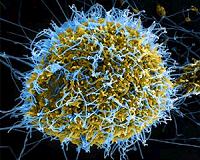 Ebola: The epidemic's timeline