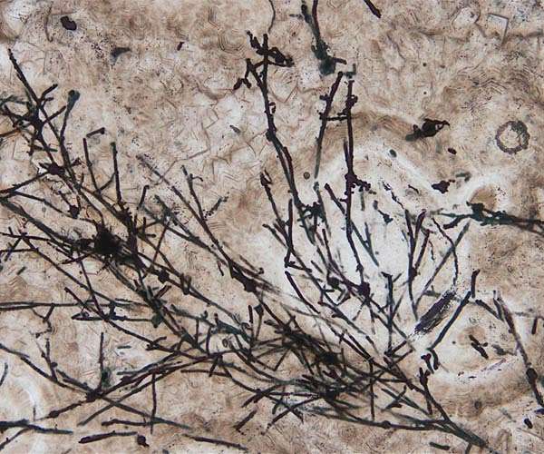Scientist wins 'Environment Nobel' for shedding light on hidden fungal networks