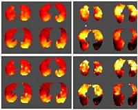 Researchers develop new method for looking into the lungs