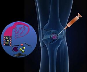 Injectable Gel Could Spell Relief For Arthritis Sufferers