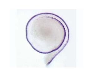 When is a gene not a gene
